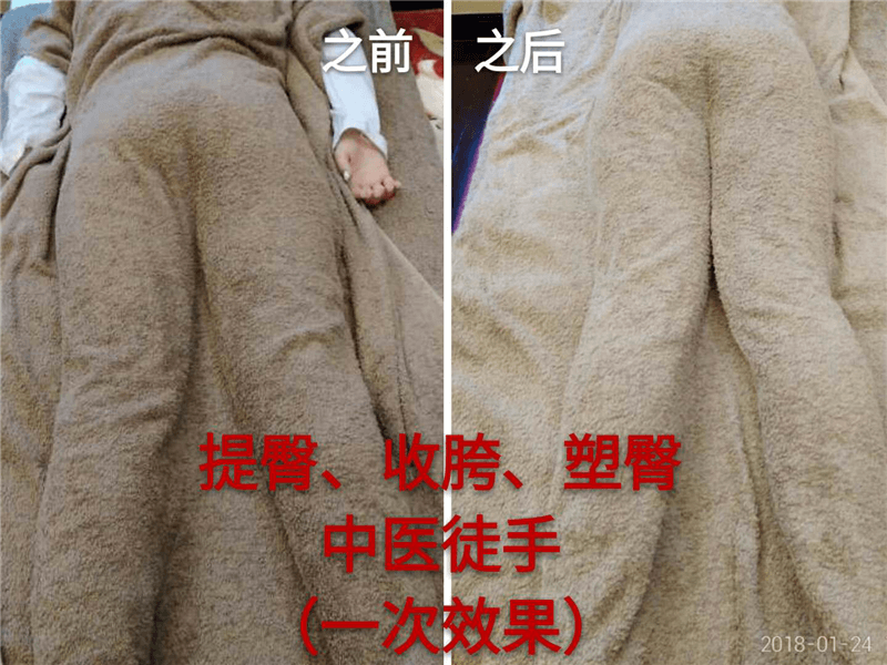 產(chǎn)后修護