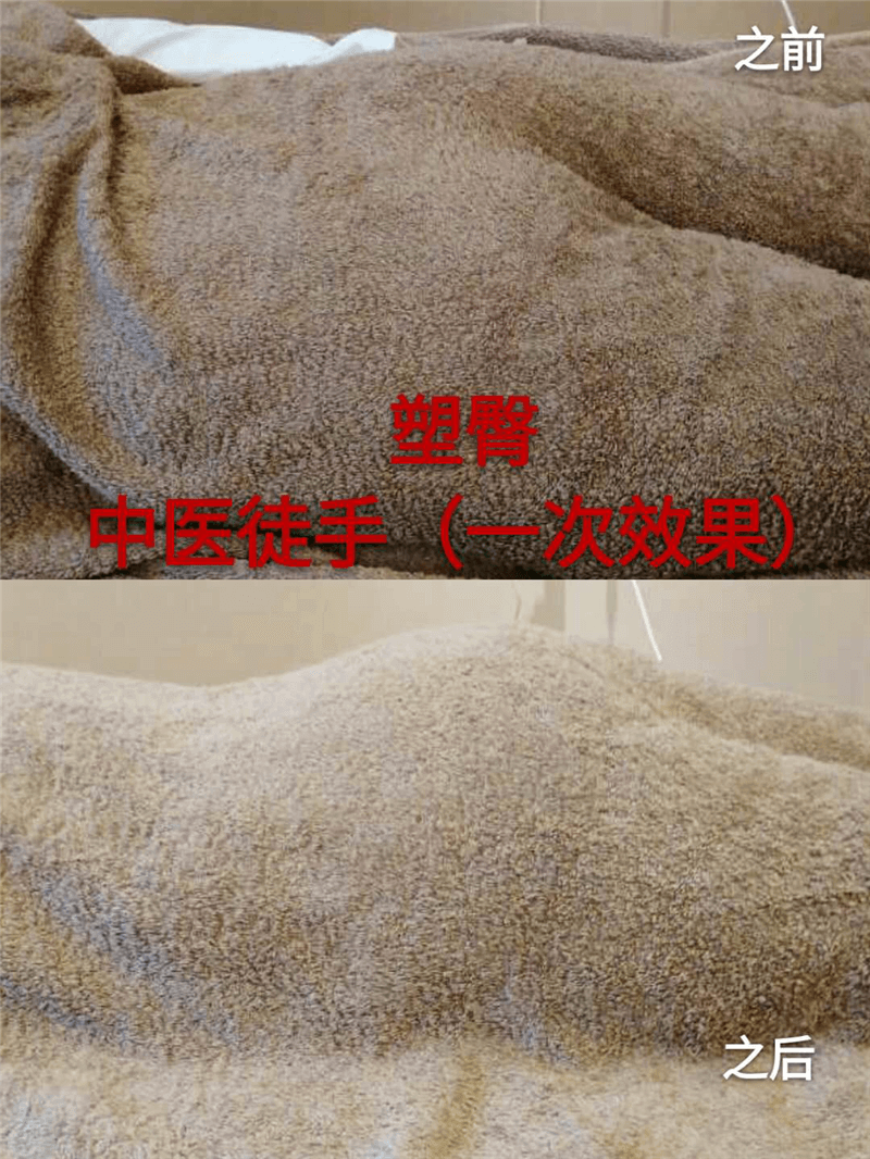 產(chǎn)后修護