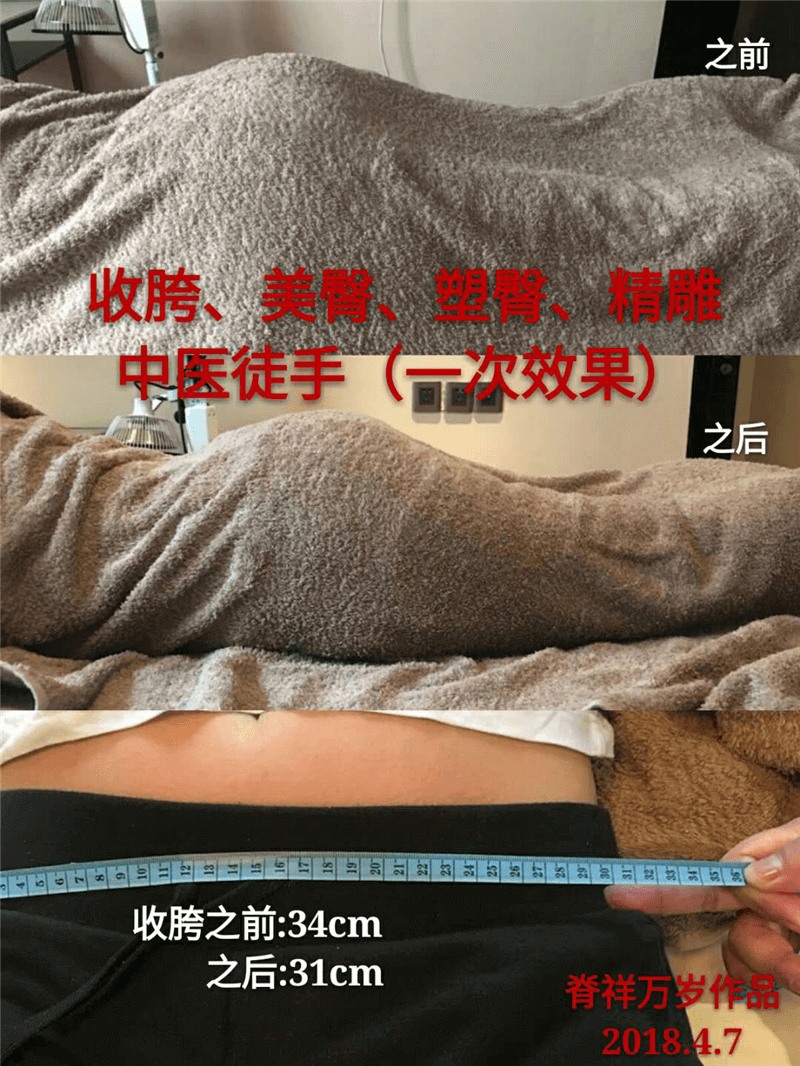 產(chǎn)后修護