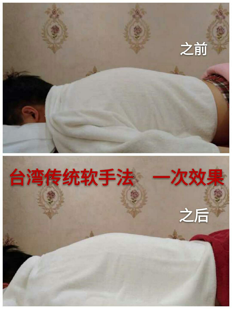 含胸駝背