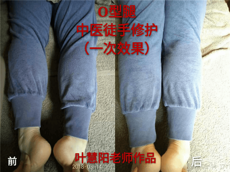 產(chǎn)品圖