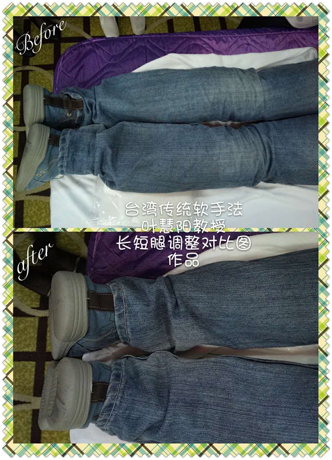 長(zhǎng)短腿修護(hù)