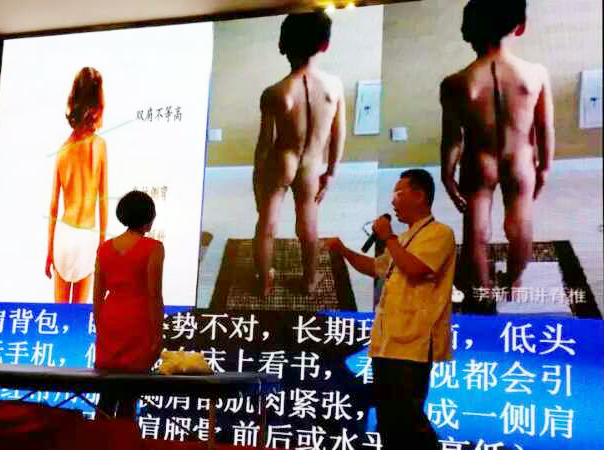 脊柱側(cè)彎公益講座 