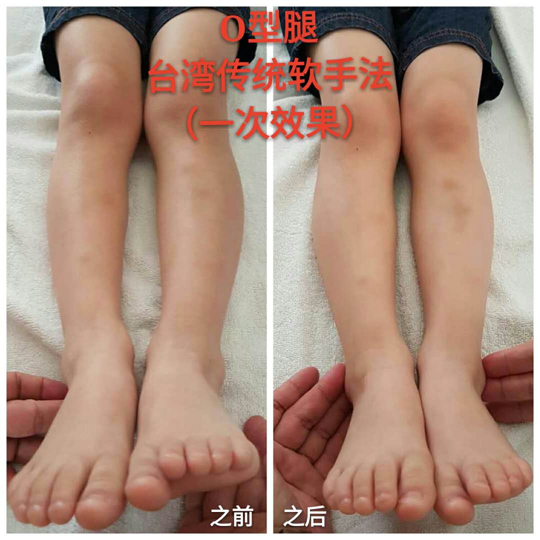產(chǎn)品圖