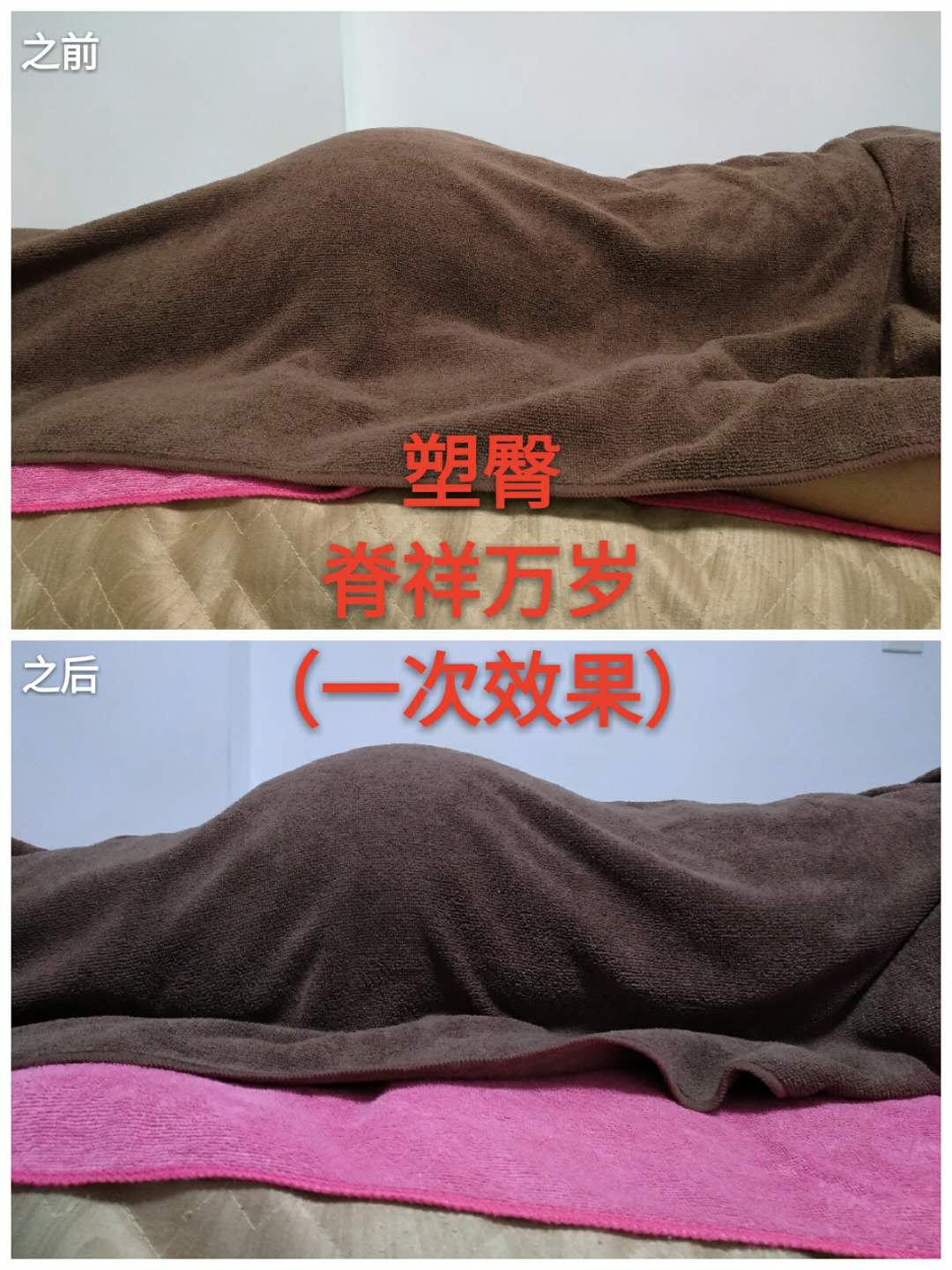 產(chǎn)后修復