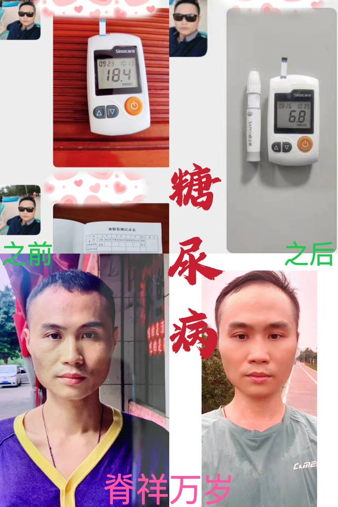 疑難雜癥