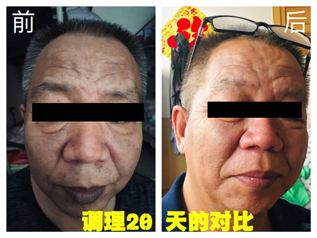 疑難雜癥