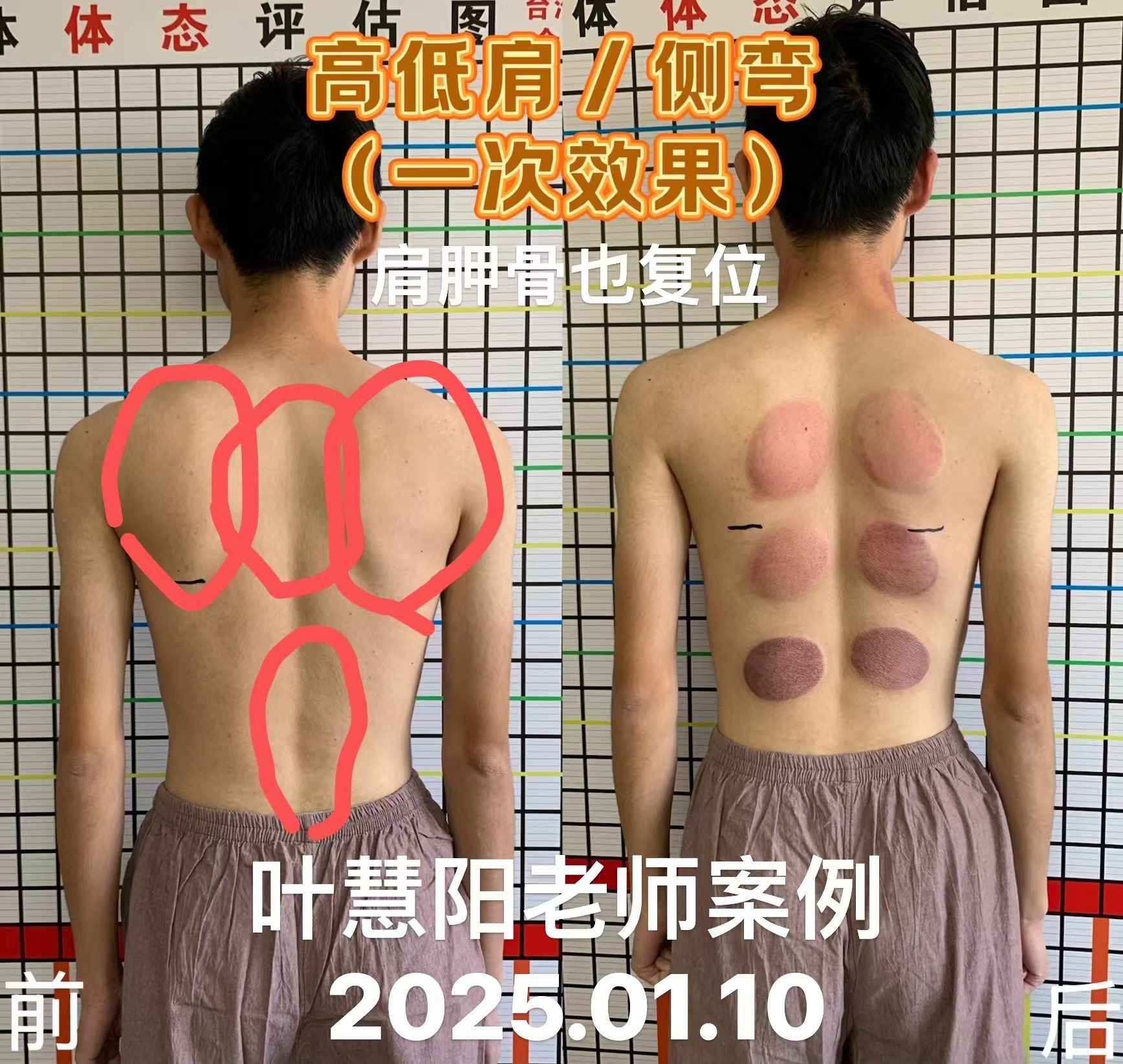 產(chǎn)品圖