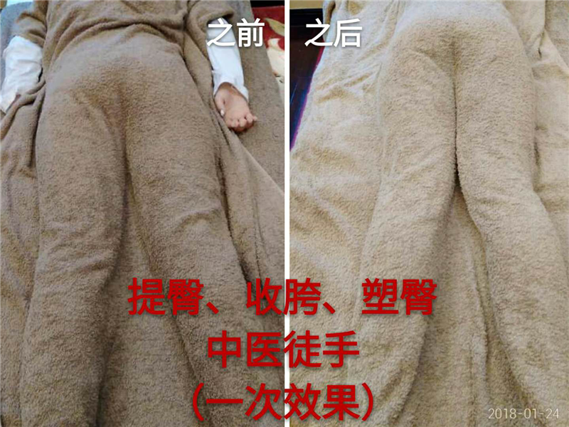 圖片20