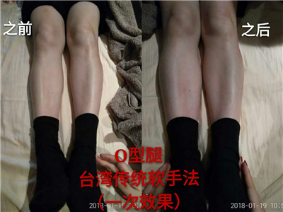 圖片32