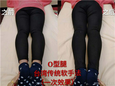 圖片35