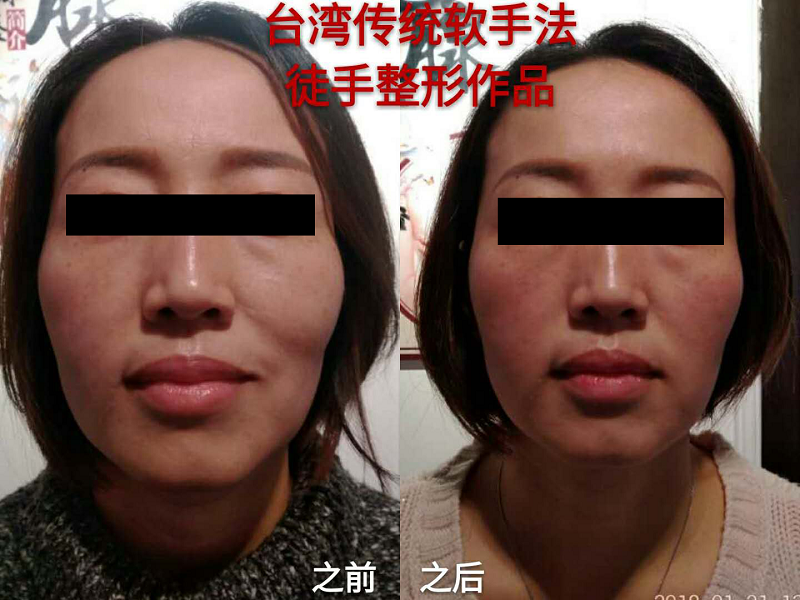 產(chǎn)品圖